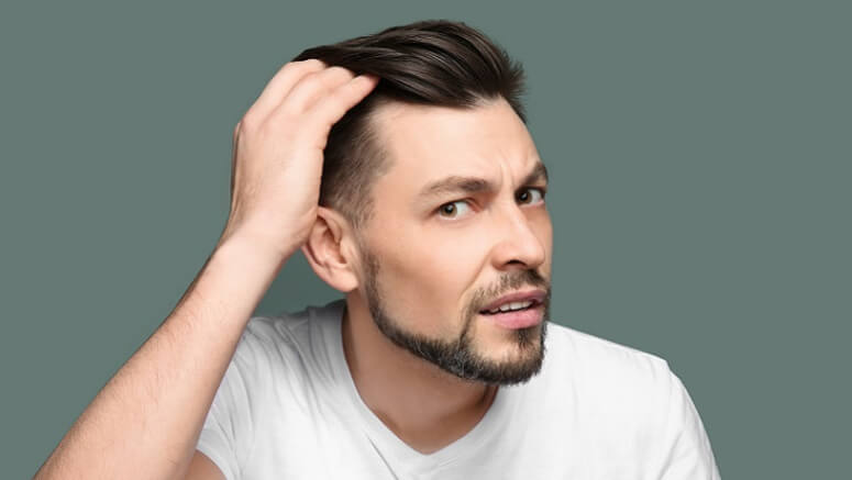 Androgenowe wypadanie włosów